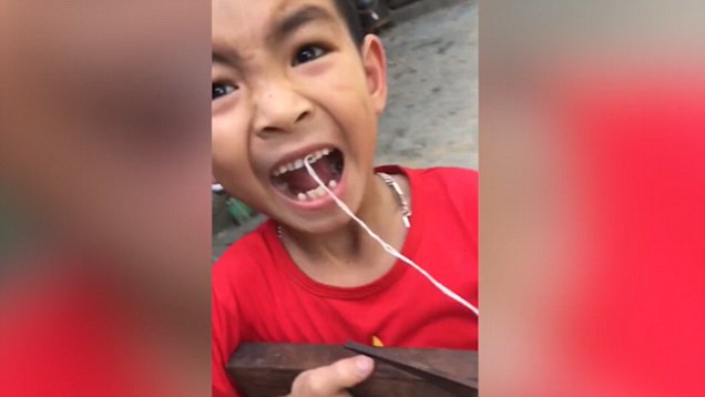 Penembakan Yang Berakhir Jadi Cabut Gigi